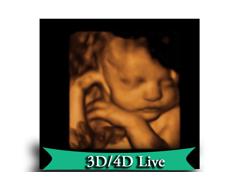 How much does it cost to get a 4d ultrasound